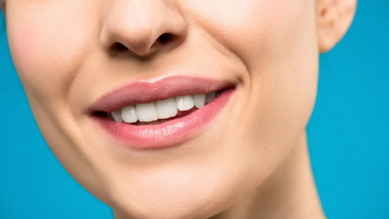Close-up of a bright white smile after teeth whitening treatment