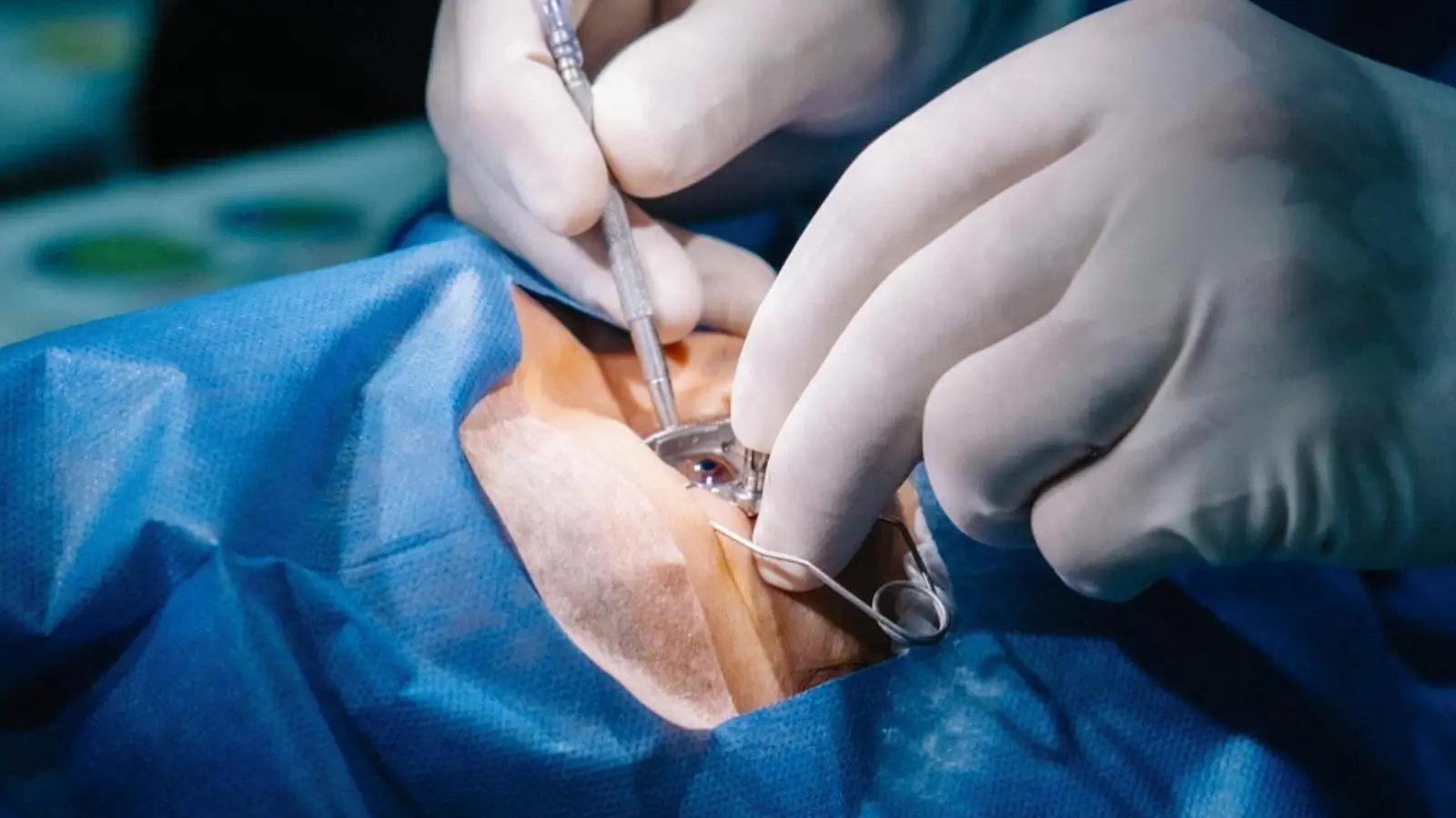 Laser eye surgeon in Melbourne using advanced equipment during a vision correction procedure